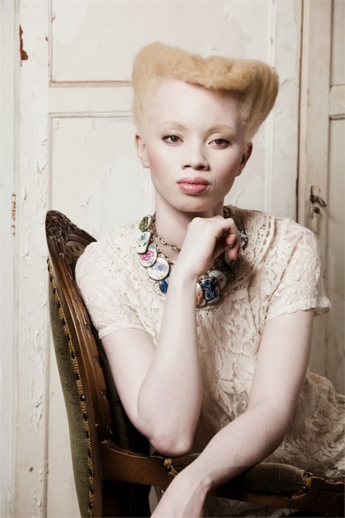 manticoreimaginary:“…I don’t know what the number of people with Albinism in Turkey is but I c