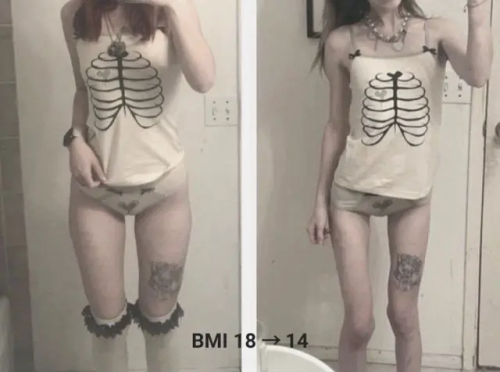 Before N After Thinspø
