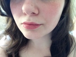 lilspirit:  freckles, scars, fat, body hairThings that are not wrong with my body