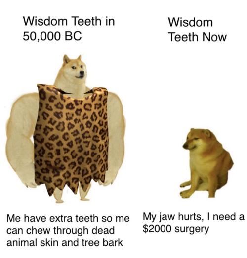 zahnegott-lives: ottosgotanothergun:   newtonpermetersquare: Chad wisdom teeth Wisdom tooth impaction is a very recent phenomenon starting mainly as a problem after the Industrial Revolution. Why Cavemen Needed No Braces Wisdom teeth are impacted due