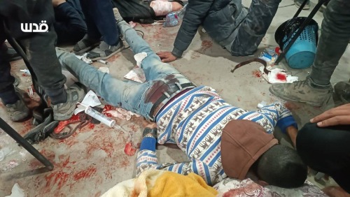 🚨 Earlier This Morning, Over 70 Palestinians Were Martyred, And Over 250 Wounded, After The IOF Opened