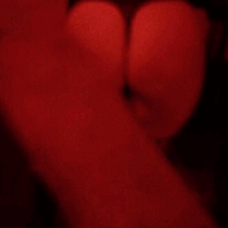thewolfatethesheep: Abuse, and bruise progression w/Suz