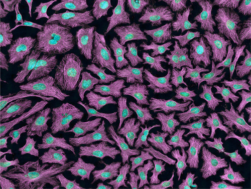 Multiphoton fluorescence image of HeLa cells with cytoskeletal microtubules (magenta) and DNA (cyan)