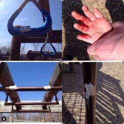 justinmilwaukee:  Can I get everyone to REBLOG this please? I can’t imagine this ever happening to kids, especially at a place MEANT for them! Teens or a group of teens are doing this in playgrounds, please watch your child(ren) at all times! REBLOG