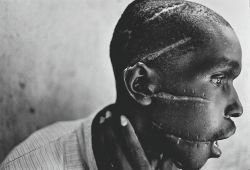 cafecitoenlechao:  djalizm:cacophagy:A Hutu man at a Red Cross hospital, his face mutilated by the Hutu ‘Interahamwe’ militia, who suspected him of sympathizing with the Tutsi rebels. (James Nachtwey) 1994   The long-lasting psychological effects