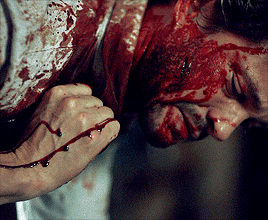 Sex nbchannibaldaily:  Will Graham + Blood pictures