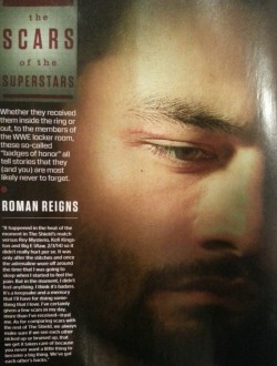 bournelitas:  &ldquo;Scars of the superstars&rdquo; (Roman Reigns)