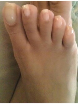 xquisitetoes:  My wife’s natural toenails.