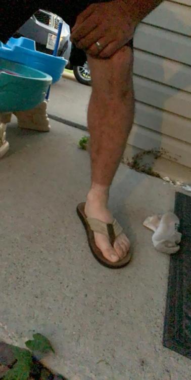 My husbands first time wearing sandals since starting his new asphalt job…