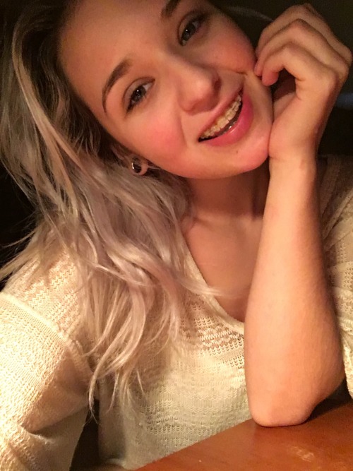 bracesworld:  Thank you so much for this blog!