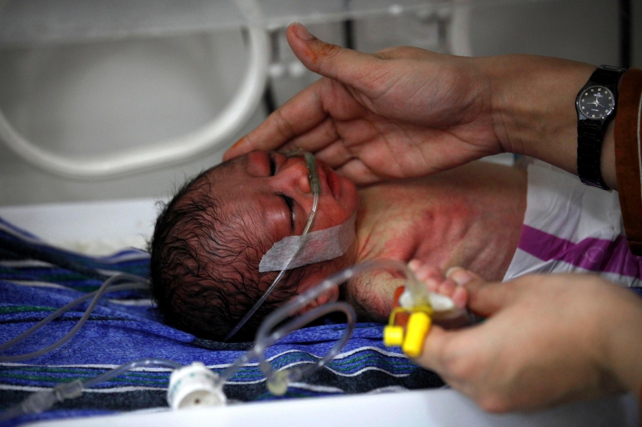PESHAWAR Un doctor trata un recién nacido en un hospital de Pakistán el 22 de febrero de 2018. Un informe de UNICEF señala a Pakistán como el país con más muertes de recién nacidos del mundo y reconoció que hacen falta reformas estructurales y más...