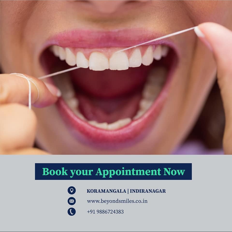 Best dentist in Bangalore | Beyond Smiles| Best dental clinic in Indiranagar