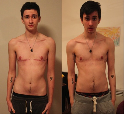 jammi-dodger:  Body change 10 months on T to 2 years 3 months on T 