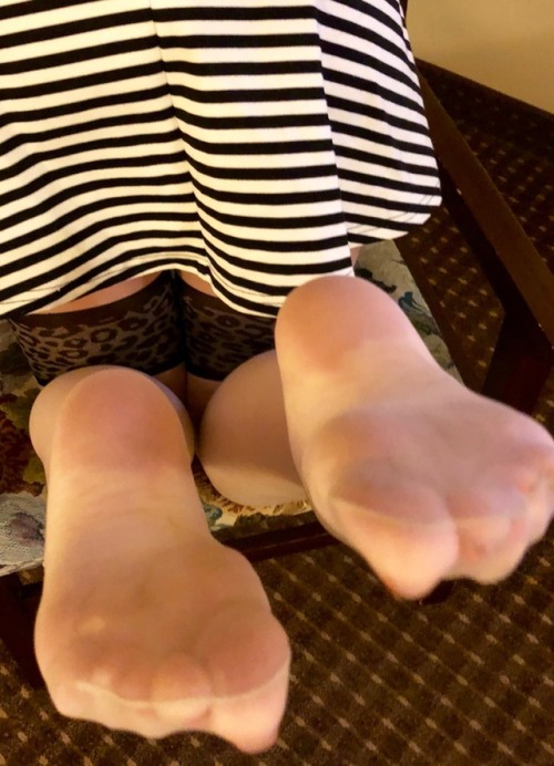 transparentfantasy - My feet need some attention because they’ve...