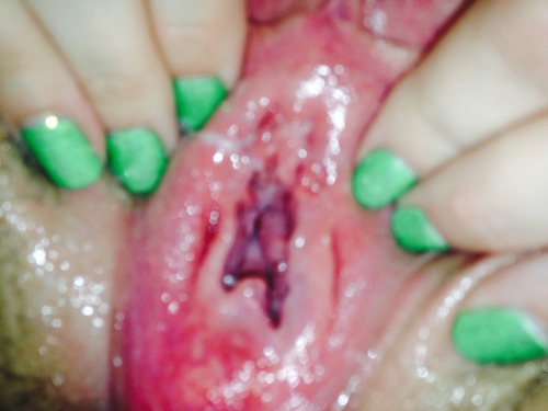 stier-und-kuh:  kinkycouplehavingfun:  Trying my best to wreck my woman’s holes  This holes needs and love to be streched.The green nails look great. And the gaping red pussy to! 