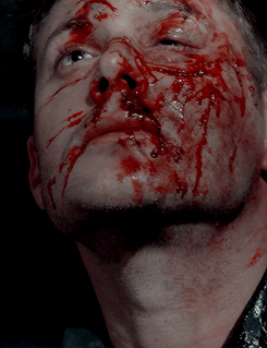dustydreamsanddirtyscars: #DEAN APPRECIATION WEEKSUNDAY: A Set Dedicated to Dean // Bruised, Bloody and Still Utterly Beautiful