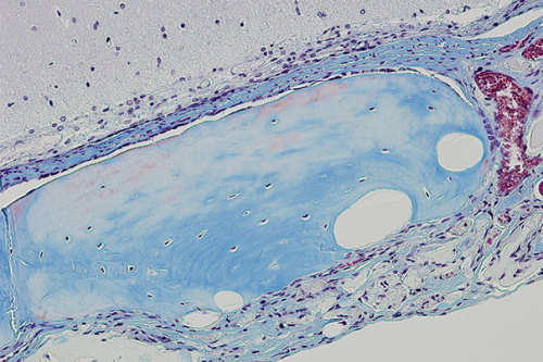  New Porous Hydrogel Could Improve the Success of Stem Cell Tissue RegenerationUsing a new porous hy