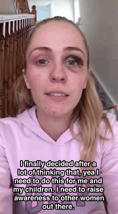huffingtonpost:  WATCH: Woman’s Powerful Video Shows The Devastating Reality Of Domestic Violence