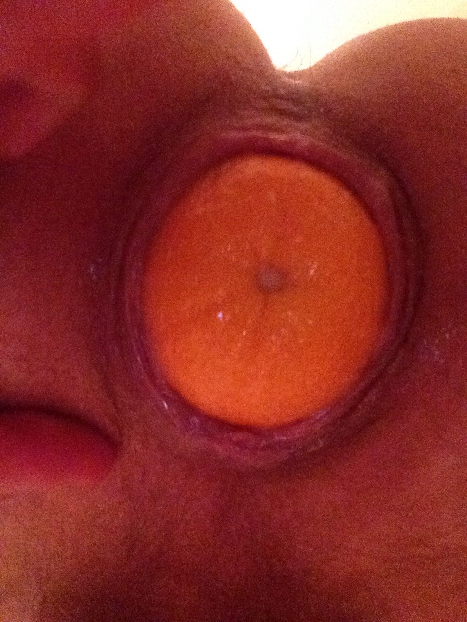 machineanddildofucked:  My ass swallowed an orange  a very good cunt stretchingFollow