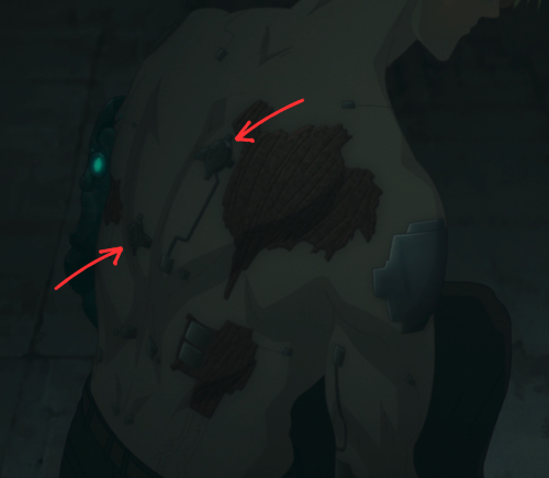 I Had CPR/AED Training At Work Recently And It Made Me Think Of The Placement Of These Two Screws Being