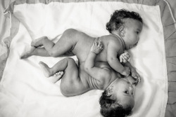 sixpenceee:  Conjoined infants survive life-Or-death SurgeryThe twin infants, Maria Clara and Maria Eduarda Santana, from Salvador, were born in May 2015 sharing an abdomen and liver.In August, photographer Mateus André snapped pictures of the babies