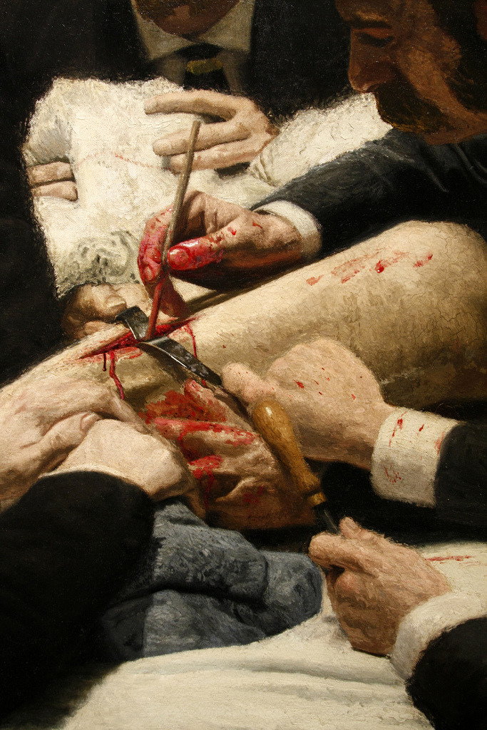   “The Gross Clinic” - Thomas Eakins - USA, 1844/1916 - Oil on canvas.  