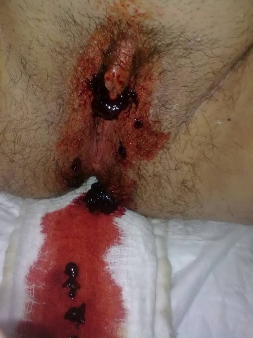 loveperiod1: Periods