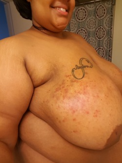 bbwlatina-love:  Pain and so much pleasure… My tits look so pretty with bruises on them and it felt so fucking good 💋💦💋💦💋