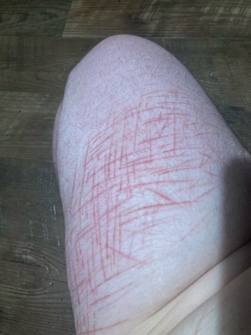 TW Self Harm!