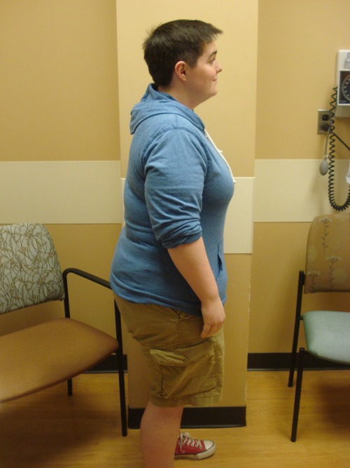 fitchris25:  strongerfasterlover:  Yesterday I went to my 1 year post op appointment. They took updated pictures of me and sent them to me this morning. I’m pretty pleased with the obvious changes to my body. My head shots are fucking horrible. But