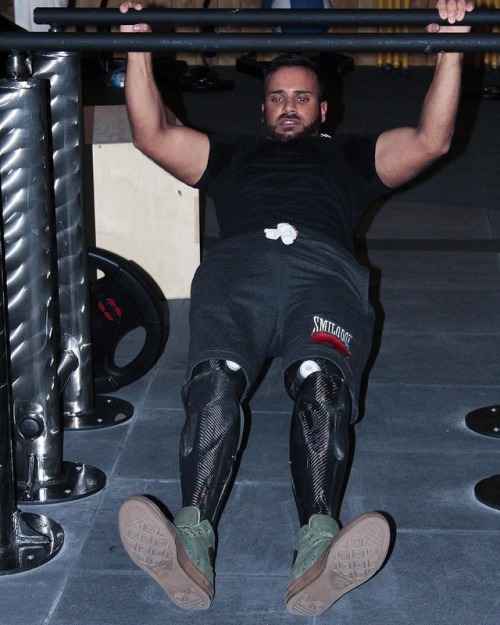 Cihad Yayman with carbon prostheses