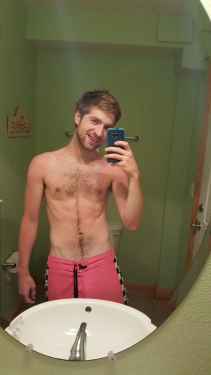 oh-isthesolution:I got just a bit burnt today at the beach