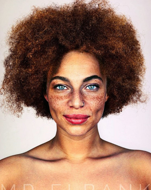 asylum-art-2:Freckled  Photographer Brock Elbank‘s ongoing project #Freckles has gathered together a