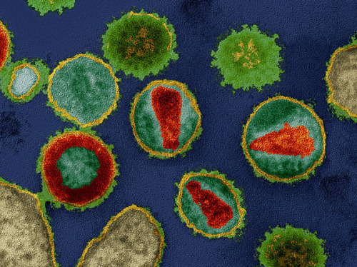 science-junkie: A very sad news: Mississippi Child Thought Cured Of HIV Shows Signs Of Infection  A 