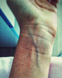 atespuskurenejderiyaa:#ensevdiğim #damar #blood #vein  (Yuksekoba Yaşam Evleri)