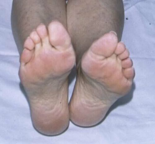 maturefeetandsoles: mature feet