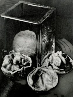 grigiabot:    Man Ray    Composition aux noix, ca. 1930  