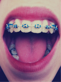 unalocaporfiada:  lips en We Heart It. http://weheartit.com/entry/69958730/via/siemprejuntas_2   