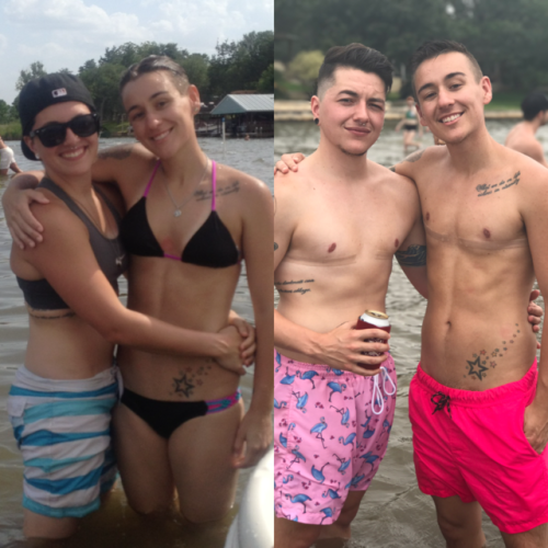 seethestarsablaze:Throwback Thursday comparison in honor of @tacotuesgay’s 1 year on T 🎉💉
