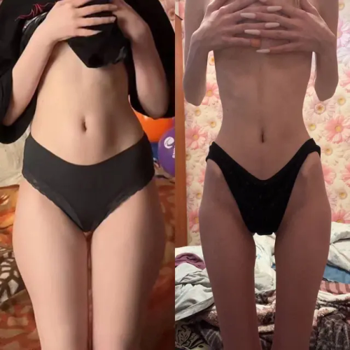 Before N After Thinspø