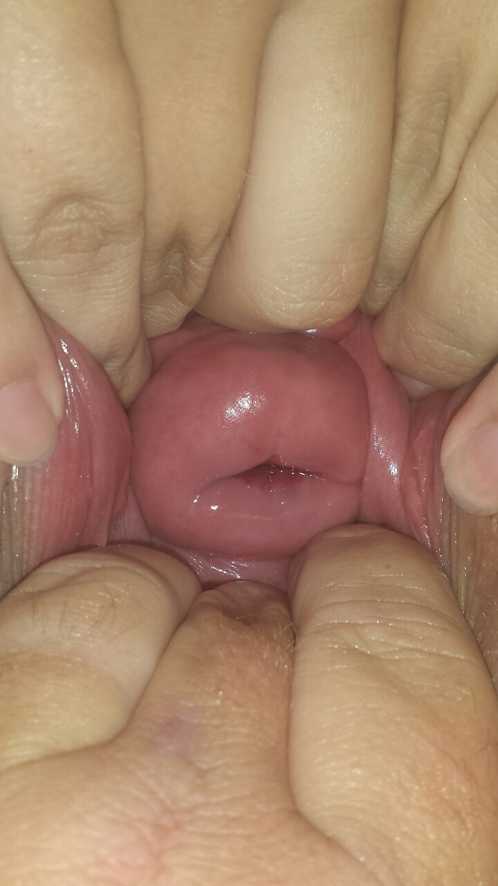 wrstdeeppussy:  stretchedcouple:  She discovered her ability to push her cervix almost