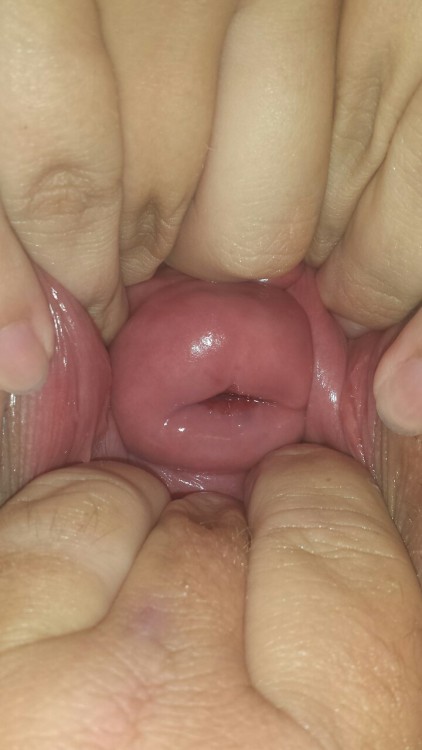 wrstdeeppussy:  stretchedcouple:  She discovered her ability to push her cervix almost all the way out!  Hot damn I’m so obsessed with the cervix push out. Its hard to do for most women. I’ve always wanted to lick a cervix. Stretchcouple  you two