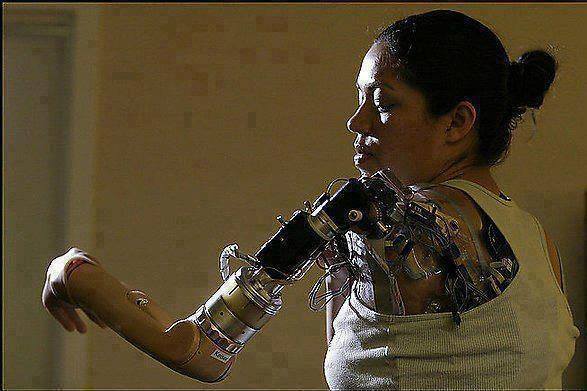 mrasmus:
“ scienceyoucanlove:
“ Meet Claudia Mitchell, the first woman with a bionic arm.
In 2006 she was outfitted with the arm to replace the arm she lost in a motorcycle accident. Her prosthesis, a prototype developed by the Rehabilitation...