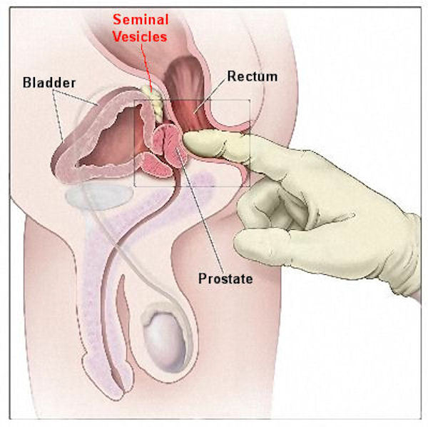 Prostate Milking and Orgasm