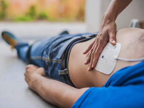 ecg-men:The defibrillator is advising chest compressions. In a moment he is going to get shocked. I 