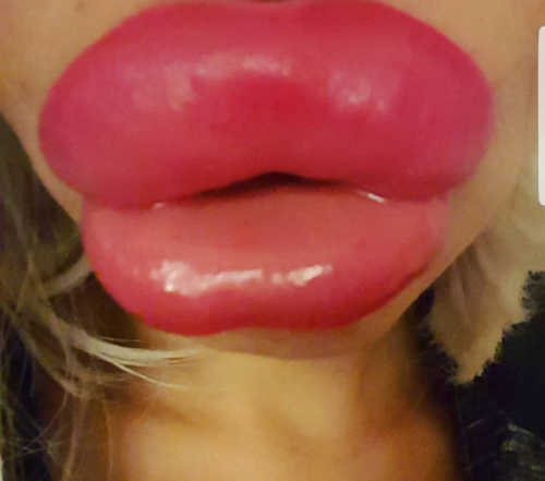 wannabebubblebuttslut: plasticpornslut:I would looooove to turn my mouth into an overinflated always
