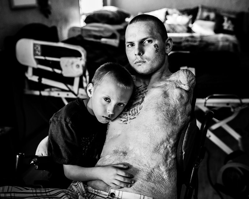 npr:  It’s impolite to stare. But when it comes to severely injured soldiers, maybe