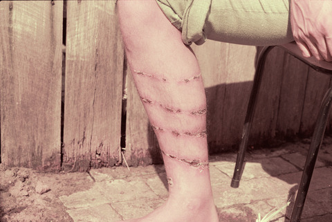 gucciballs:Rules & Displacement Activities Part II, Leg Spiral (Mike Parr, 1975)Infected Leg Spiral  (Mike Parr, 1975)  