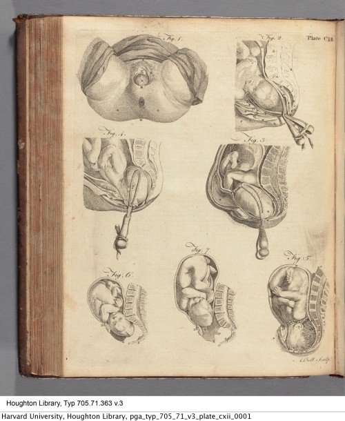 Encyclopaedia Britannica : or, A dictionary of arts and sciences, 1771.Typ 705.71.363Houghton Librar