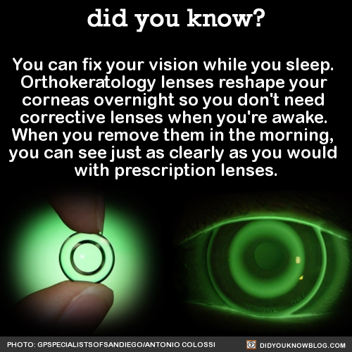 did-you-kno:  You can fix your vision while you sleep.  Orthokeratology lenses reshape your  corneas overnight so you don’t need  corrective lenses when you’re awake.  When you remove them in the morning,  you can see just as clearly as you would